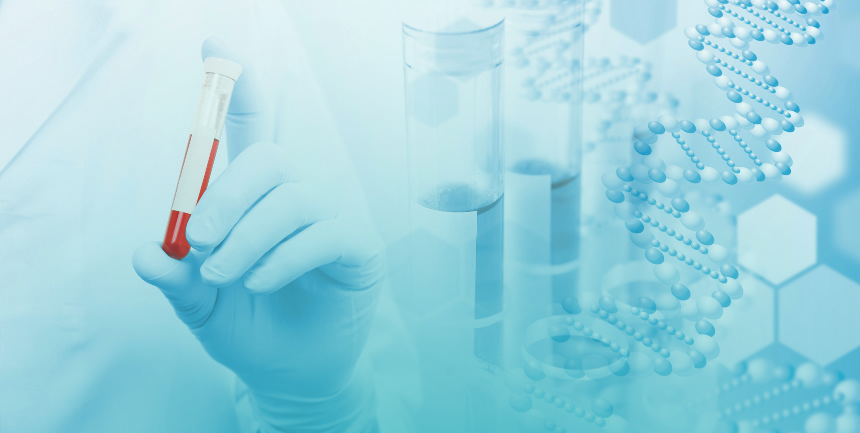What is treponema pallidum antibody？