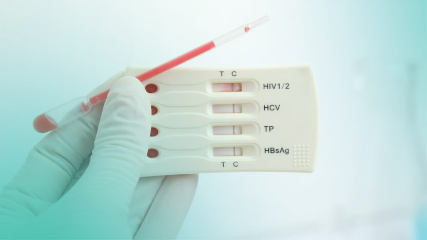 STD HIV TP syphilis HBsAg test