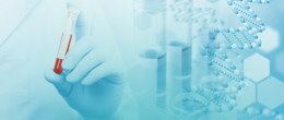 What is treponema pallidum antibody？